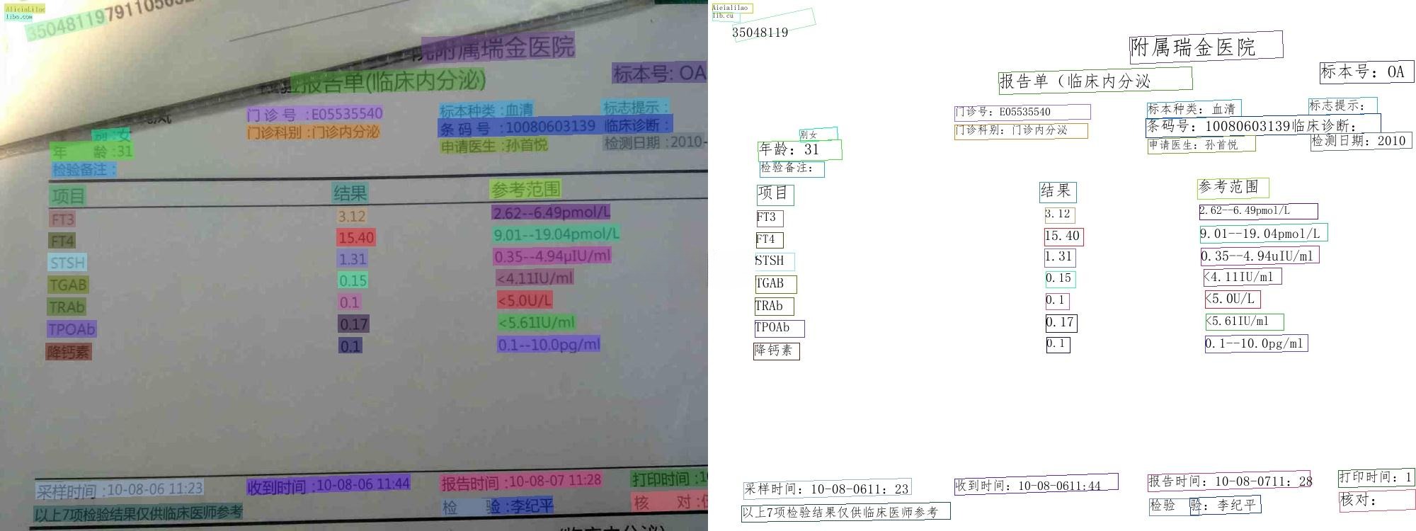 PaddleOCR 2025 文字识别工具库，支持多语言与文档处理